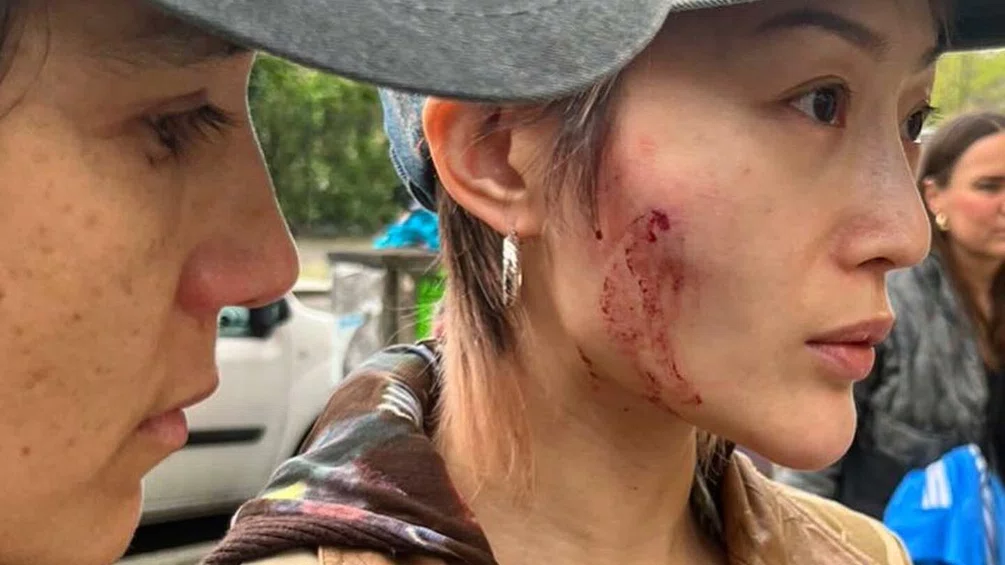 DJs Kim Ann Foxman and Cora injured following apparent hate crime attack in Berlin