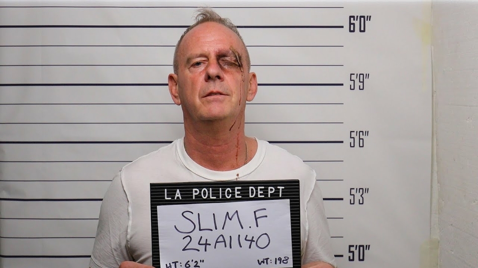 Fatboy Slim posing as if he's about to get his mugshot taken. He has a black eye